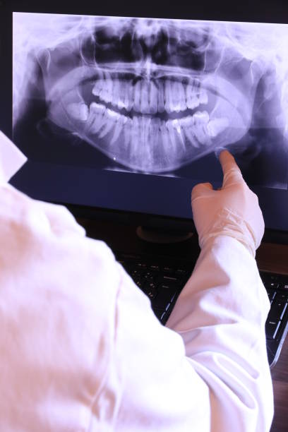 Best Emergency Wisdom Tooth Extraction in North Tonawanda, NY